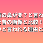 堀田茜の鼻が変？と言われる理由を昔の画像と比較！でかいと言われる理由とは