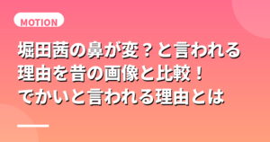 堀田茜の鼻が変？と言われる理由を昔の画像と比較！でかいと言われる理由とは