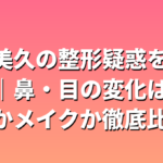 田中美久の整形疑惑を検証｜鼻・目の変化は成長かメイクか徹底比較